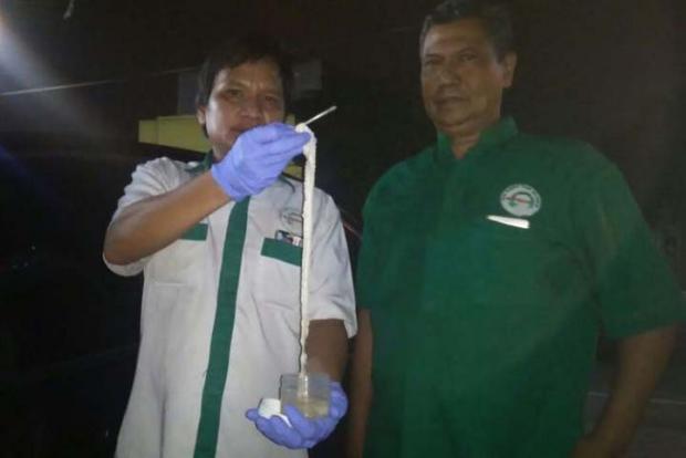 Ngeri, Cacing Pita Sepanjang 10,5 Meter Ditemukan dalam Tubuh Pasien di Simalungun