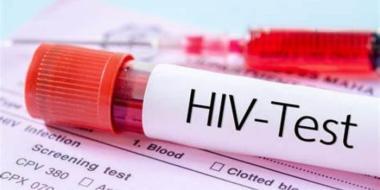 bkasus-hiv-di-riau-meningkat-dinas-kesehatan-edukasi-pencegahan-di-lingkungan-kampusb