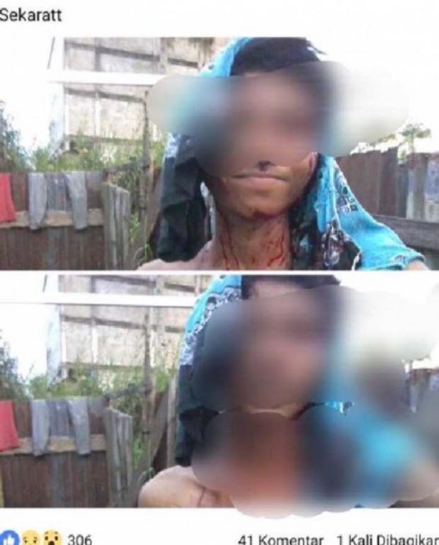 Aneh! Usai Dibacok, Seorang Remaja di Tembilahan Malah <i>Selfie</i> dan Unggah Fotonya Berlumuran Darah ke Facebook