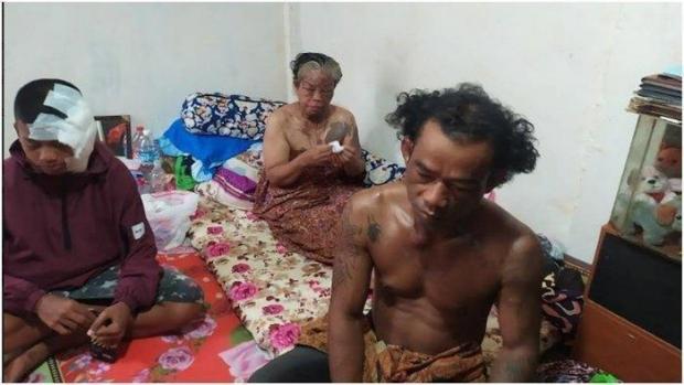 Satu Keluarga di Palembang Disiram Air Keras oleh Orang tak Dikenal yang Tiba-Tiba Masuk Rumah