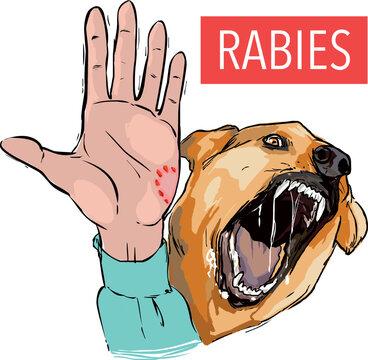 bkasus-rabies-di-riau-5-warga-meninggalb