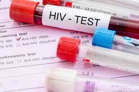 <b>250 Kasus HIV Baru Ditemukan di Kepulauan Riau Sepanjang Januari hingga April 2025</b>