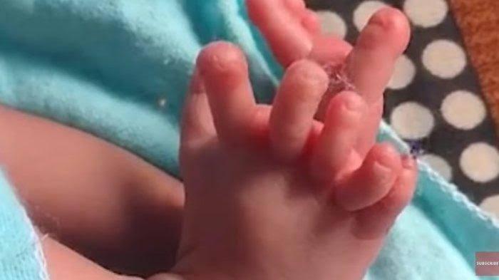 Pasangan Suami Istri di Klaten Jateng Meninggal Berpelukan, Bayi Usia 4 Bulan Menangis di Sampingnya