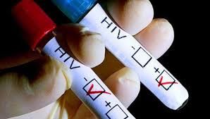 Warga Inhu yang Ingin Tes HIV Sekarang Bisa di Puskesmas