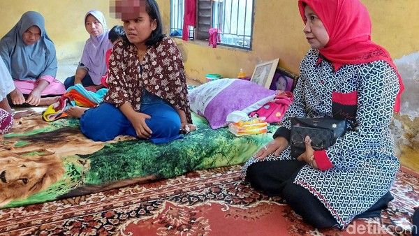 Sri Rahayu Penderita Kanker Tiroid di Pekanbaru Dirujuk ke RS Hasan Sadikin, Penanganan Medis Dilakukan dengan Ablasi