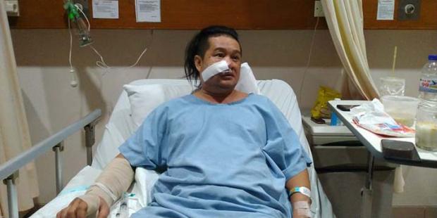 Tjoa Tjin Wie Nyaris Tewas setelah Dibacok Satpam Saat Sedang Makan di Pujasera Dekat Arena Gelper Pekanbaru