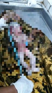 Begini Kondisi Bayi Malang yang Sengaja Dikubur di Halaman Rumah Warga di Tenayan Pekanbaru