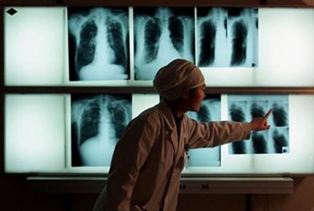 Penyakit TBC Renggut 81 Jiwa di Riau pada 2015